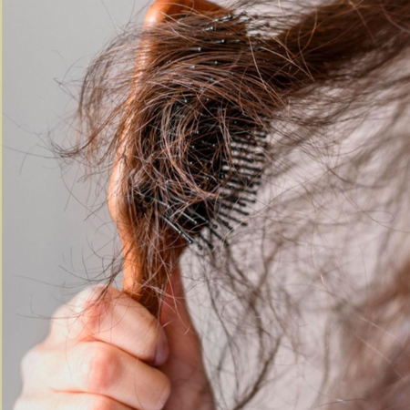 Severe Hair Fall
